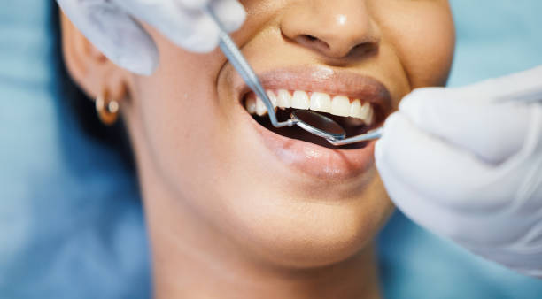Best Emergency Denture Repair in Union City, GA